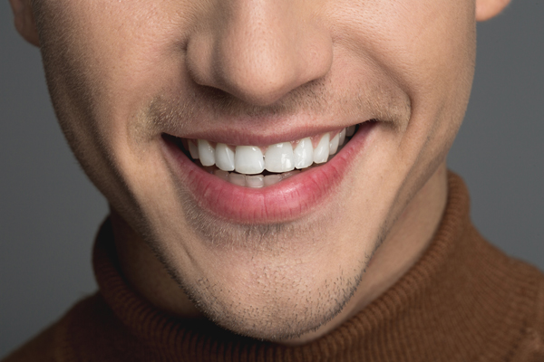 Professional Teeth Whitening Vs  At Home Kits: What Works Best?